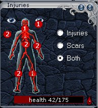 Graphical dipiction of injuries sustained as seen using Stormfront Interface